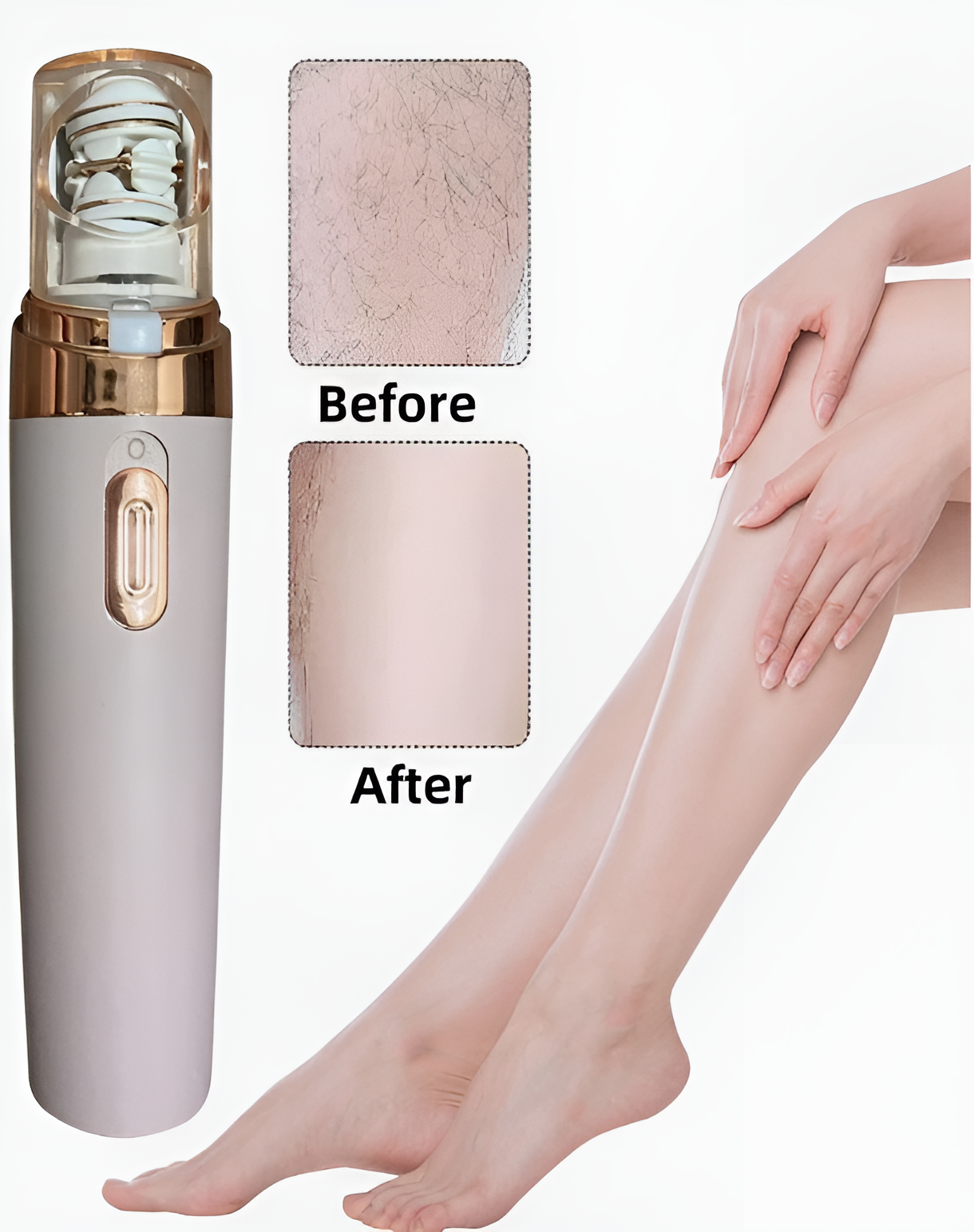 AussieSmooth™ 3-in-1 Epilator