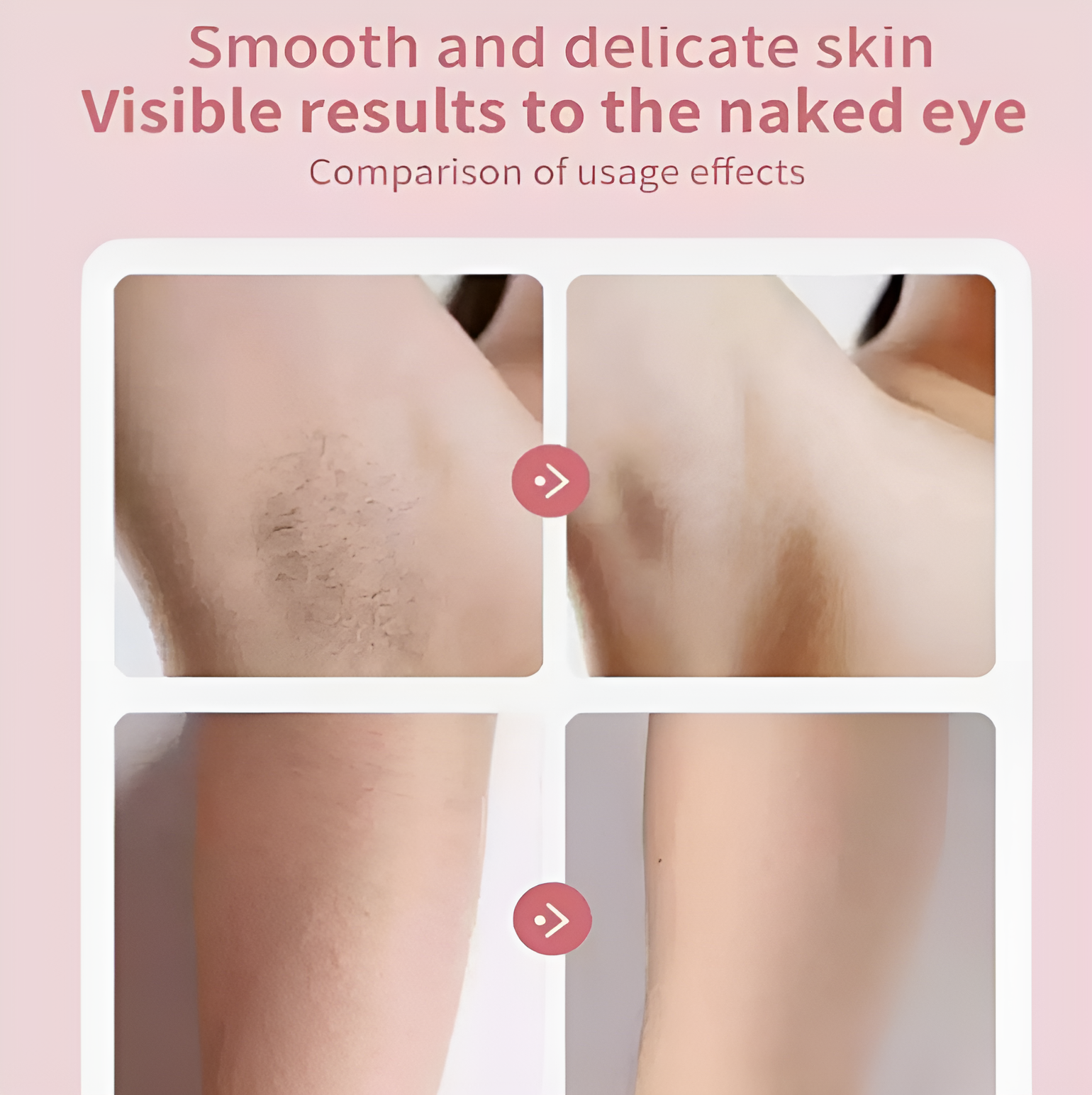 AussieSmooth™ 3-in-1 Epilator